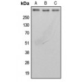 LifeSab™ BRCA2 Rabbit pAb (50 µl)