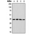 LifeSab™ Cathepsin H Rabbit pAb (50 µl)