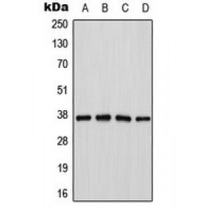 LifeSab™ Cathepsin H Rabbit pAb (50 µl)