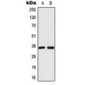 LifeSab™ AKR1C1 Rabbit pAb (50 µl)
