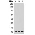 LifeSab™ Midkine Rabbit pAb (50 µl)