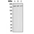 LifeSab™ ASK1 Rabbit pAb (50 µl)