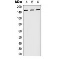 LifeSab™ PLC gamma 1 (pY783) Rabbit pAb (50 µl)