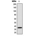 LifeSab™ SRSF7 Rabbit pAb (50 µl)