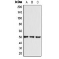LifeSab™ GLUT4 Rabbit pAb (50 µl)
