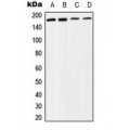 LifeSab™ BAF170 Rabbit pAb (50 µl)