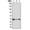 LifeSab™ AP2 gamma Rabbit pAb (50 µl)