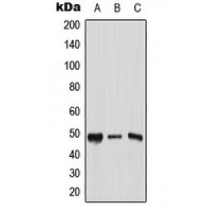 LifeSab™ AP2 gamma Rabbit pAb (50 µl)