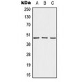 LifeSab™ AKAP5 Rabbit pAb (50 µl)