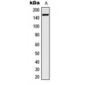 LifeSab™ ZEB2 Rabbit pAb (50 µl)