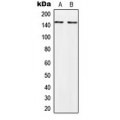 LifeSab™ PALLD Rabbit pAb (50 µl)