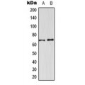 LifeSab™ CDKL3 Rabbit pAb (50 µl)