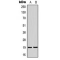 LifeSab™ NSG2 Rabbit pAb (50 µl)