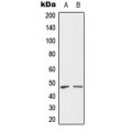 LifeSab™ SH3GLB2 Rabbit pAb (50 µl)