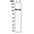 LifeSab™ CCP2 Rabbit pAb (50 µl)