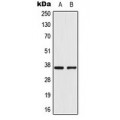 LifeSab™ AKR1CL2 Rabbit pAb (50 µl)