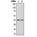 LifeSab™ KLF1/5/7 Rabbit pAb (50 µl)