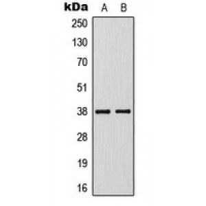 LifeSab™ KLF1/5/7 Rabbit pAb (50 µl)