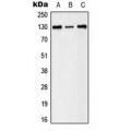 LifeSab™ EPHB1/2 (pY594/604) Rabbit pAb (50 µl)