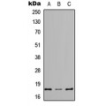 LifeSab™ REG4 Rabbit pAb (50 µl)