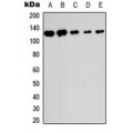 LifeSab™ SENP6 Rabbit pAb (50 µl)
