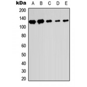 LifeSab™ SENP6 Rabbit pAb (50 µl)