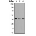 LifeSab™ ABHD4 Rabbit pAb (50 µl)