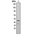 LifeSab™ ATG4B Rabbit pAb (50 µl)