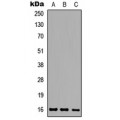 LifeSab™ Ataxin 7L1 Rabbit pAb (50 µl)