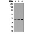 LifeSab™ CD68 Rabbit pAb (50 µl)