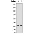 LifeSab™ CDCA7 Rabbit pAb (50 µl)