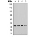 LifeSab™ CHST6 Rabbit pAb (50 µl)