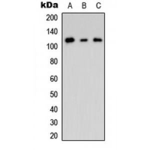 LifeSab™ CNK2 Rabbit pAb (50 µl)