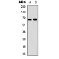 LifeSab™ DDX5 Rabbit pAb (50 µl)