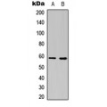 LifeSab™ Estrogen Receptor beta Rabbit pAb (50 µl)