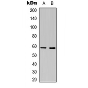 LifeSab™ Estrogen Receptor beta Rabbit pAb (50 µl)