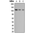 LifeSab™ GAB1 (pY627) Rabbit pAb (50 µl)