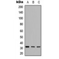 LifeSab™ GCLM Rabbit pAb (50 µl)