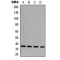LifeSab™ GLB1L3 Rabbit pAb (50 µl)