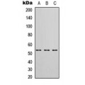 LifeSab™ HIBADH Rabbit pAb (50 µl)