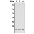 LifeSab™ MP68 Rabbit pAb (50 µl)
