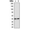 LifeSab™ IDOL Rabbit pAb (50 µl)