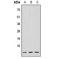 LifeSab™ NDUFV3 Rabbit pAb (50 µl)