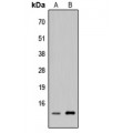 LifeSab™ p311 Rabbit pAb (50 µl)