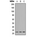 LifeSab™ PIGF Rabbit pAb (50 µl)
