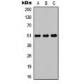 LifeSab™ POTEA Rabbit pAb (50 µl)