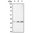 LifeSab™ RAD52B Rabbit pAb (50 µl)