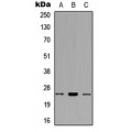 LifeSab™ RNF125 Rabbit pAb (50 µl)