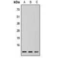 LifeSab™ RPLP2 Rabbit pAb (50 µl)