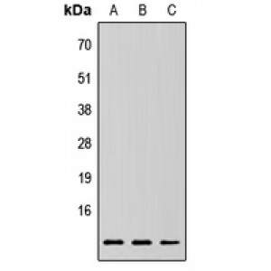 LifeSab™ RPLP2 Rabbit pAb (50 µl)